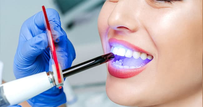 Estética dental