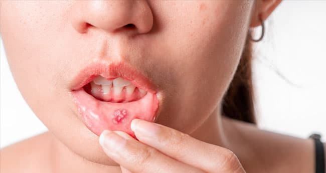 Medicina oral