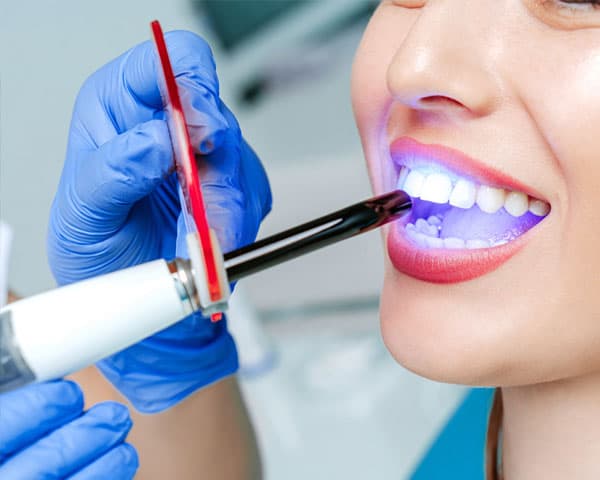 Estética dental en Ourense